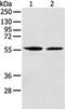 Flavin Containing Dimethylaniline Monoxygenase 5 antibody, PA5-51185, Invitrogen Antibodies, Western Blot image 