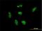 Ribosomal Protein L21 antibody, H00006144-M03, Novus Biologicals, Immunocytochemistry image 