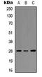 Homeobox C8 antibody, LS-C354398, Lifespan Biosciences, Western Blot image 