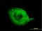 SH3 Domain Binding Protein 2 antibody, H00006452-M01, Novus Biologicals, Immunofluorescence image 