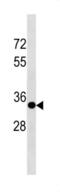 Sprouty RTK Signaling Antagonist 3 antibody, abx034644, Abbexa, Western Blot image 