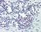 Phospholipase C Gamma 1 antibody, orb88119, Biorbyt, Immunohistochemistry paraffin image 