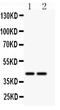 CD244 Molecule antibody, PA2057, Boster Biological Technology, Western Blot image 