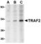 TNF Receptor Associated Factor 2 antibody, TA306277, Origene, Western Blot image 