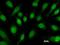 Core-Binding Factor Subunit Beta antibody, LS-C342588, Lifespan Biosciences, Immunofluorescence image 