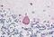 Homeobox A10 antibody, MBS248400, MyBioSource, Immunohistochemistry paraffin image 