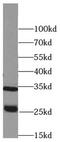 Serine Protease 2 antibody, FNab06833, FineTest, Western Blot image 