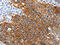 Sorting Nexin 5 antibody, CSB-PA287873, Cusabio, Immunohistochemistry paraffin image 