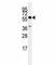 Cell Division Cycle 25C antibody, F50837-0.4ML, NSJ Bioreagents, Western Blot image 