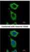 Aldehyde Dehydrogenase 1 Family Member A1 antibody, NBP2-15334, Novus Biologicals, Immunofluorescence image 
