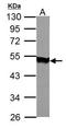 Acylglycerol Kinase antibody, NBP1-32163, Novus Biologicals, Western Blot image 