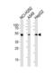 Aldehyde Dehydrogenase 2 Family Member antibody, TA324332, Origene, Western Blot image 