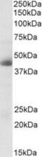 Carbonic Anhydrase 12 antibody, MBS423483, MyBioSource, Western Blot image 