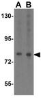SKI Proto-Oncogene antibody, GTX85522, GeneTex, Western Blot image 