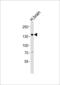 Ovostatin homolog 1 antibody, PA5-49356, Invitrogen Antibodies, Western Blot image 