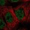 MAP3K7 C-Terminal Like antibody, NBP2-56145, Novus Biologicals, Immunofluorescence image 