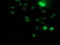 Ribosomal Protein S6 Kinase B1 antibody, M01475-2, Boster Biological Technology, Immunofluorescence image 