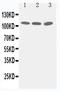 Tight Junction Protein 3 antibody, PA1972, Boster Biological Technology, Western Blot image 