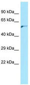 Adaptor Related Protein Complex 4 Subunit Mu 1 antibody, TA332088, Origene, Western Blot image 