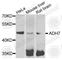 Alcohol Dehydrogenase 7 (Class IV), Mu Or Sigma Polypeptide antibody, A7871, ABclonal Technology, Western Blot image 