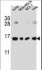 H2A Histone Family Member J antibody, LS-C166757, Lifespan Biosciences, Western Blot image 