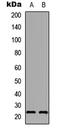 Serotonin acetylase antibody, LS-C358889, Lifespan Biosciences, Western Blot image 