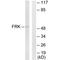 Fyn Related Src Family Tyrosine Kinase antibody, PA5-49805, Invitrogen Antibodies, Western Blot image 