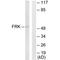 Fyn Related Src Family Tyrosine Kinase antibody, PA5-49805, Invitrogen Antibodies, Western Blot image 