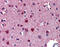 Retinoic Acid Receptor Beta antibody, ARP45601_P050, Aviva Systems Biology, Immunohistochemistry frozen image 