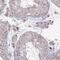 Zinc Finger And SCAN Domain Containing 9 antibody, HPA054512, Atlas Antibodies, Immunohistochemistry paraffin image 