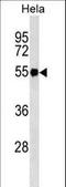 Fibrinogen Gamma Chain antibody, LS-C159653, Lifespan Biosciences, Western Blot image 