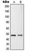 Ras Association Domain Family Member 8 antibody, LS-C353315, Lifespan Biosciences, Western Blot image 