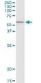 Elongator Acetyltransferase Complex Subunit 3 antibody, H00055140-D01P, Novus Biologicals, Western Blot image 