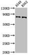 Calpain 1 antibody, CSB-PA004490EA01HU, Cusabio, Western Blot image 