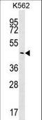 Phosphatidylinositol Specific Phospholipase C X Domain Containing 2 antibody, LS-C203694, Lifespan Biosciences, Western Blot image 