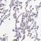 Thymidine Phosphorylase antibody, NBP1-84916, Novus Biologicals, Immunohistochemistry frozen image 