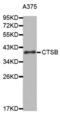 Cathepsin B antibody, abx000540, Abbexa, Western Blot image 