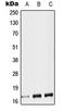 Tachykinin Precursor 1 antibody, LS-C353790, Lifespan Biosciences, Western Blot image 