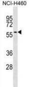 UDP Glucuronosyltransferase Family 2 Member A3 antibody, abx029751, Abbexa, Western Blot image 