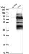 Hepatocyte Growth Factor-Regulated Tyrosine Kinase Substrate antibody, NBP1-83202, Novus Biologicals, Western Blot image 