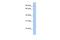 Protein O-Mannosyltransferase 2 antibody, A04876, Boster Biological Technology, Western Blot image 