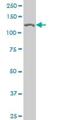 Cullin Associated And Neddylation Dissociated 1 antibody, H00055832-M04, Novus Biologicals, Western Blot image 