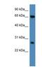 Kelch Repeat And BTB Domain Containing 8 antibody, NBP1-91502, Novus Biologicals, Western Blot image 