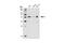 Induced myeloid leukemia cell differentiation protein Mcl-1 antibody, 4572S, Cell Signaling Technology, Western Blot image 