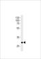 Homeobox D9 antibody, LS-C204019, Lifespan Biosciences, Western Blot image 