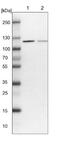 VPS50 Subunit Of EARP/GARPII Complex antibody, NBP1-88012, Novus Biologicals, Western Blot image 