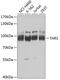 Threonyl-TRNA Synthetase antibody, GTX65852, GeneTex, Western Blot image 