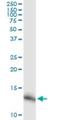 NADH:Ubiquinone Oxidoreductase Subunit A5 antibody, H00004698-M02, Novus Biologicals, Western Blot image 