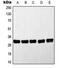 MYD88 Innate Immune Signal Transduction Adaptor antibody, MBS821175, MyBioSource, Western Blot image 