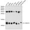 S100 Calcium Binding Protein A10 antibody, A1987, ABclonal Technology, Western Blot image 